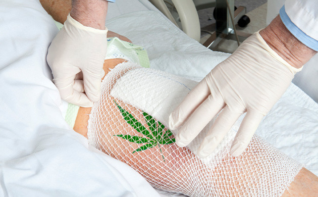 Заживление ран каннабисом Заживление ран послеоперационных пациентов