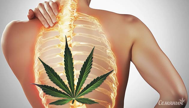 Боль в суставах: причины и последствия Хроническая боль в суставах и каннабис