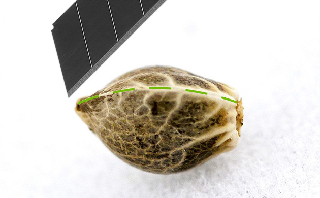 Удаление шва семечка каннабиса