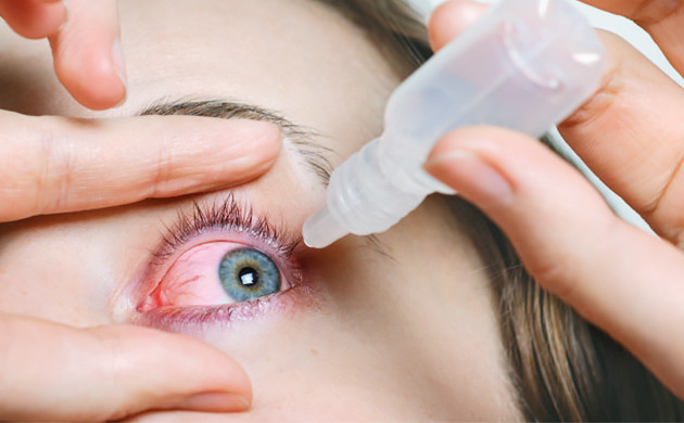 Как избавиться от красных глаз Как избавиться от красных глаз при курении конопли